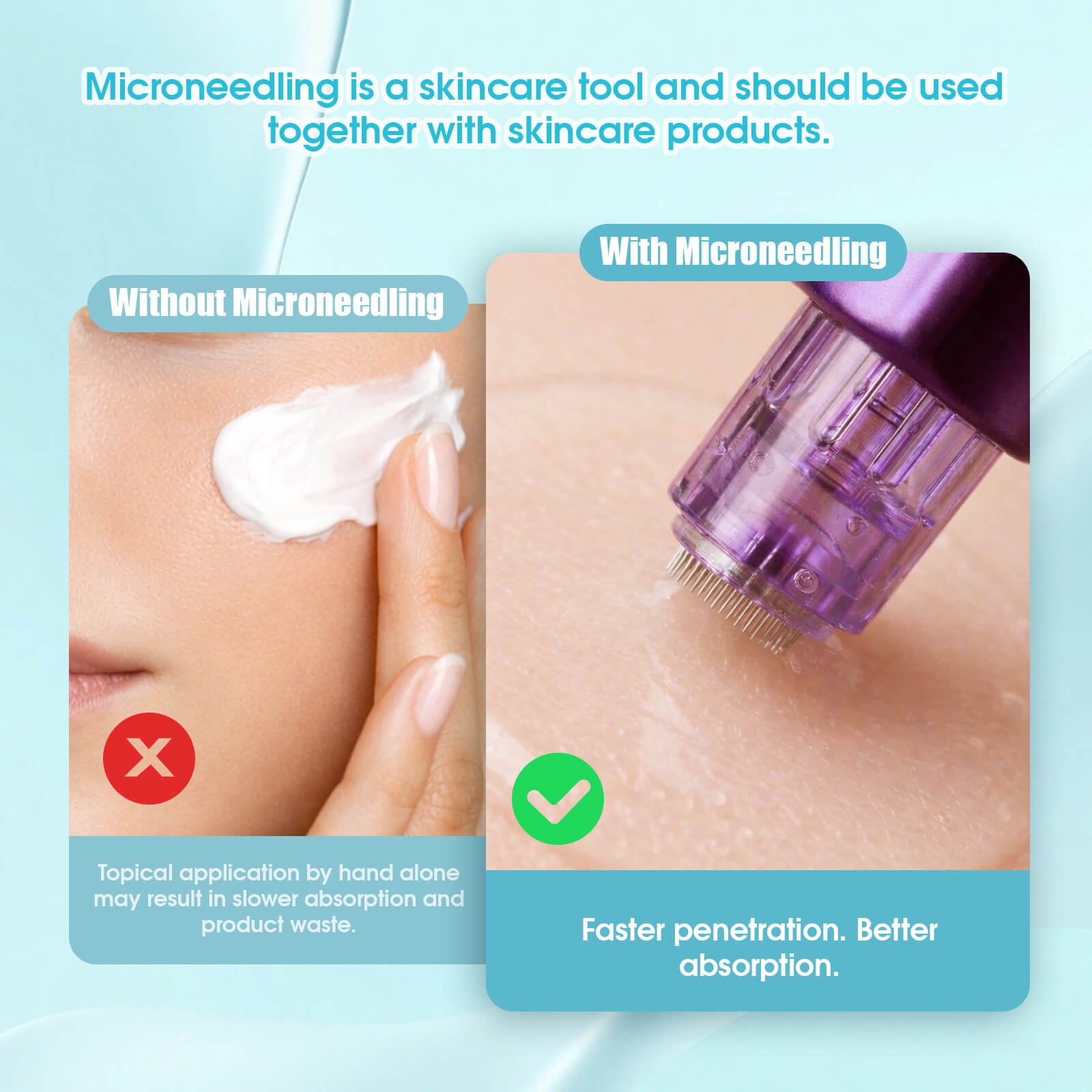 MAST Cartucce con microaghi per macchine per tatuaggi – Misure miste, confezione da 4 - immagine 10